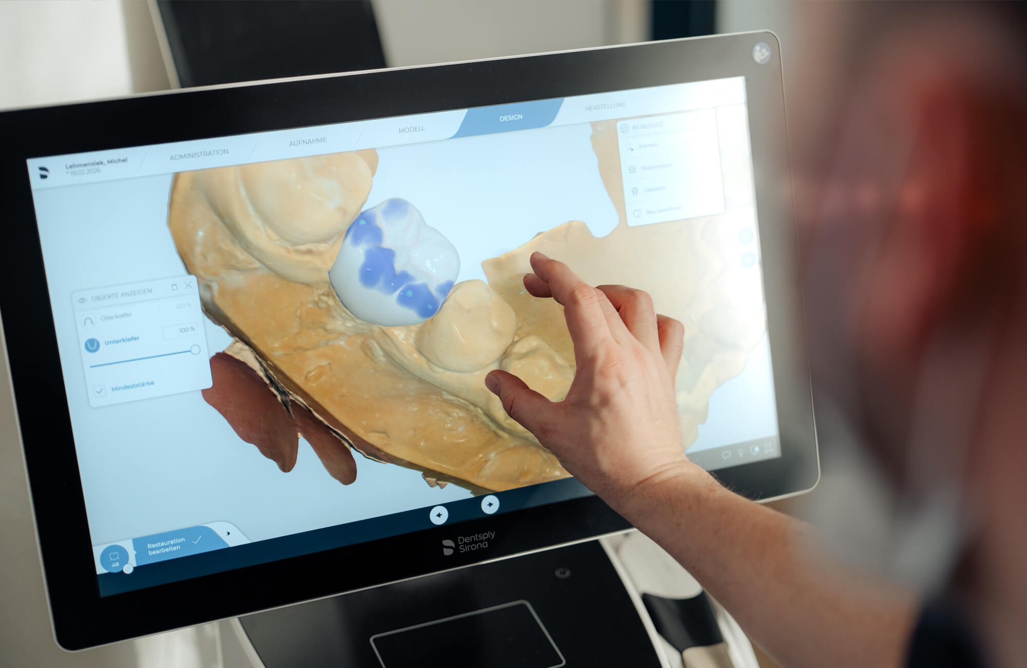 Das computergestützte Design (CAD) für die Implanthologie